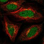 ADAT1 Antibody in Immunocytochemistry (ICC/IF)
