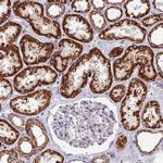 ADAT1 Antibody in Immunohistochemistry (Paraffin) (IHC (P))
