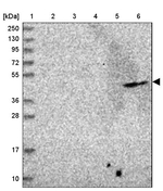 ADAT1 Antibody in Western Blot (WB)