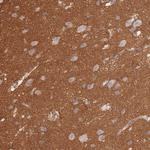 GNB4 Antibody in Immunohistochemistry (Paraffin) (IHC (P))