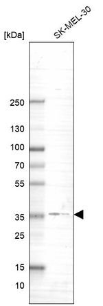 GNB4 Antibody in Western Blot (WB)