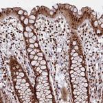 LEO1 Antibody in Immunohistochemistry (Paraffin) (IHC (P))