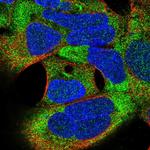 TSR3 Polyclonal Antibody