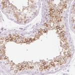 TSP50 Polyclonal Antibody