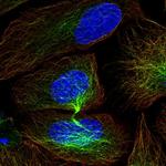 CIS Polyclonal Antibody