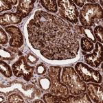 CIS Antibody in Immunohistochemistry (Paraffin) (IHC (P))