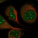 IP6K1 Polyclonal Antibody