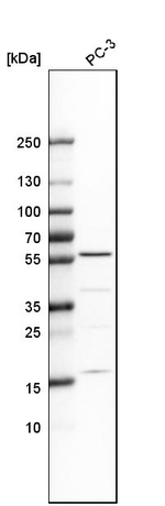 IP6K1 Antibody in Western Blot (WB)