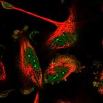 Bora Polyclonal Antibody