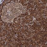 Bora Antibody in Immunohistochemistry (Paraffin) (IHC (P))