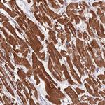 TID1 Antibody in Immunohistochemistry (Paraffin) (IHC (P))