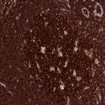 ADAT1 Antibody in Immunohistochemistry (Paraffin) (IHC (P))