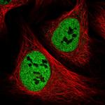 PPP4R1 Polyclonal Antibody