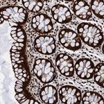 PPP4R1 Antibody in Immunohistochemistry (Paraffin) (IHC (P))