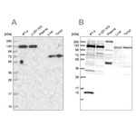 PPP4R1 Antibody in Western Blot (WB)