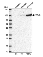 PPP4R1 Antibody in Western Blot (WB)