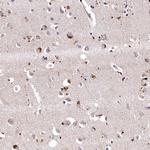 LSM4 Antibody in Immunohistochemistry (Paraffin) (IHC (P))