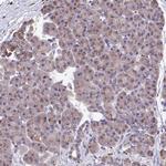 LSM4 Antibody in Immunohistochemistry (Paraffin) (IHC (P))