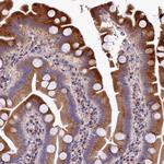 LSM4 Antibody in Immunohistochemistry (Paraffin) (IHC (P))
