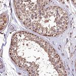 LSM4 Polyclonal Antibody