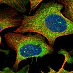 RTN1 Polyclonal Antibody