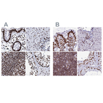 RALY Antibody in Immunohistochemistry (Paraffin) (IHC (P))