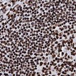 RALY Antibody in Immunohistochemistry (Paraffin) (IHC (P))