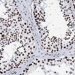 RALY Antibody in Immunohistochemistry (Paraffin) (IHC (P))