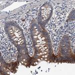 GLUT10 Polyclonal Antibody