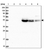 GLUT10 Antibody in Western Blot (WB)