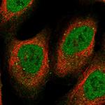 RFC5 Polyclonal Antibody