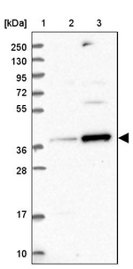 RFC5 Antibody in Western Blot (WB)
