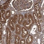 KID Polyclonal Antibody