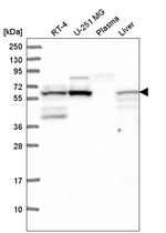 FTO Antibody in Western Blot (WB)