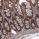 PPP4R1 Antibody in Immunohistochemistry (Paraffin) (IHC (P))