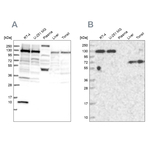 PPP4R1 Antibody in Western Blot (WB)
