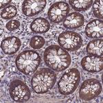 PSMF1 Antibody in Immunohistochemistry (Paraffin) (IHC (P))