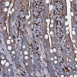 ORP2 Antibody in Immunohistochemistry (Paraffin) (IHC (P))