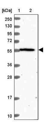 ORP2 Antibody in Western Blot (WB)