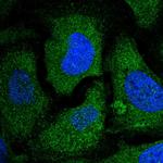 eIF2 beta Polyclonal Antibody