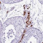 ZSCAN5 Polyclonal Antibody