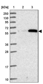 ZSCAN5 Antibody in Western Blot (WB)