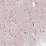 KPNA2 Antibody in Immunohistochemistry (Paraffin) (IHC (P))