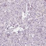 KPNA2 Antibody in Immunohistochemistry (Paraffin) (IHC (P))