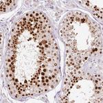 KPNA2 Antibody in Immunohistochemistry (Paraffin) (IHC (P))