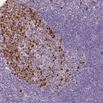KPNA2 Antibody in Immunohistochemistry (Paraffin) (IHC (P))