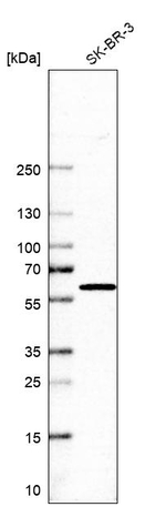 KPNA2 Antibody in Western Blot (WB)