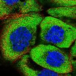 PSMF1 Polyclonal Antibody