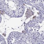 TTLL13 Antibody in Immunohistochemistry (Paraffin) (IHC (P))