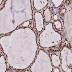 DNAJC3 Polyclonal Antibody